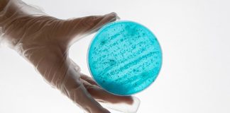 Salud realizará campañas de vacunación específica en los municipios con brotes, aunque la comunidad supera la tasa del 95% recomendada por la OMS´.